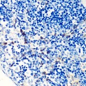 Anti-FSP1/S100A4 antibody produced in rabbit