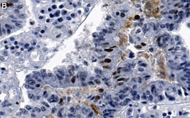 Anti-phospho-Chk2-Thr68 Antibody, clone 1B17 ZooMAb® Rabbit Monoclonal recombinant, expressed in HEK 293 cells