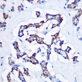 Anti-CBS antibody produced in rabbit