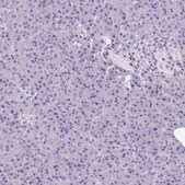 Anti-MORC4 antibody produced in rabbit Prestige Antibodies® Powered by Atlas Antibodies, affinity isolated antibody, buffered aqueous glycerol solution