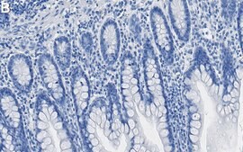 Anti-Musashi-1 Antibody, clone 2I14 ZooMAb® Rabbit Monoclonal recombinant, expressed in HEK 293 cells