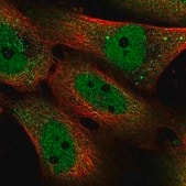 Anti-SMAD5 antibody produced in rabbit Prestige Antibodies® Powered by Atlas Antibodies, affinity isolated antibody, buffered aqueous glycerol solution