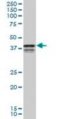 Monoclonal Anti-PCBP2 antibody produced in mouse clone 3A1, purified immunoglobulin, buffered aqueous solution