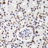 Anti-Phospho-STAT5A-Y694 antibody produced in rabbit