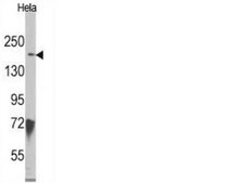 抗-JMJD3（NT）抗体 from rabbit