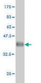 Monoclonal Anti-MT antibody produced in mouse clone 2F2, purified immunoglobulin, buffered aqueous solution