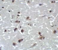 Anti-CD81 antibody produced in rabbit affinity isolated antibody