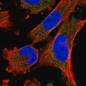 抗-FREM2 兔抗 Prestige Antibodies® Powered by Atlas Antibodies, affinity isolated antibody, buffered aqueous glycerol solution