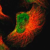 Anti-FOXN2 antibody produced in rabbit Prestige Antibodies® Powered by Atlas Antibodies, affinity isolated antibody, buffered aqueous glycerol solution