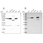 Anti-GBE1 antibody produced in rabbit Prestige Antibodies® Powered by Atlas Antibodies, affinity isolated antibody, buffered aqueous glycerol solution