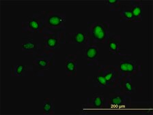 Monoclonal Anti-ACTN4 antibody produced in mouse clone 4D10, purified immunoglobulin, buffered aqueous solution