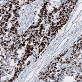 Monoclonal Anti-SALL4 antibody produced in mouse Prestige Antibodies® Powered by Atlas Antibodies, clone CL12183, purified immunoglobulin, buffered aqueous glycerol solution