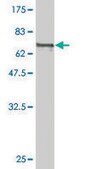 Monoclonal Anti-CALR antibody produced in mouse clone 1G11-1A9, purified immunoglobulin, buffered aqueous solution