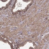 Anti-PPP1R12A antibody produced in rabbit Prestige Antibodies® Powered by Atlas Antibodies, affinity isolated antibody
