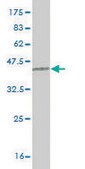 Monoclonal Anti-RNF168 antibody produced in mouse clone 3E1, purified immunoglobulin, buffered aqueous solution