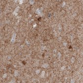 Monoclonal Anti-GAD1 antibody produced in mouse Prestige Antibodies® Powered by Atlas Antibodies, clone CL2919, purified immunoglobulin, buffered aqueous glycerol solution