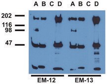Monoclonal Anti-EGFR (PhosphoTyr1173) antibody produced in mouse clone EM-13