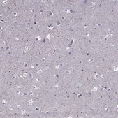 Anti-SPTBN4 antibody produced in rabbit Prestige Antibodies® Powered by Atlas Antibodies, affinity isolated antibody, buffered aqueous glycerol solution