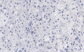 Anti-SCARB1 Antibody, clone 3B15 ZooMAb® Rabbit Monoclonal recombinant, expressed in HEK 293 cells