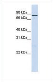 Anti-NOTCH1 antibody produced in rabbit affinity isolated antibody