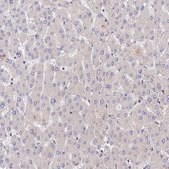Anti-PPP2R2B antibody produced in rabbit Prestige Antibodies® Powered by Atlas Antibodies, affinity isolated antibody, buffered aqueous glycerol solution