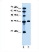 Anti-PTCH1 antibody produced in rabbit affinity isolated antibody