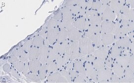 Anti-Fibroblast Antibody, clone TE-7 ZooMAb® Mouse Monoclonal recombinant, expressed in HEK 293 cells