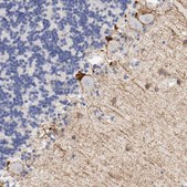 Anti-KIT antibody produced in rabbit affinity isolated antibody, buffered aqueous glycerol solution