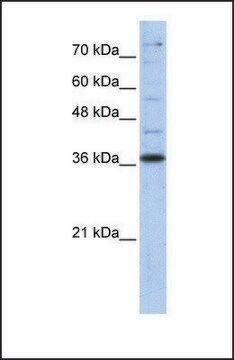 抗-GAPDH 兔抗 affinity isolated antibody