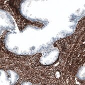 Monoclonal Anti-ITGA1 antibody produced in mouse Prestige Antibodies® Powered by Atlas Antibodies, clone CL7217, purified immunoglobulin, buffered aqueous glycerol solution