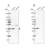 Anti-PCNA antibody produced in rabbit Prestige Antibodies® Powered by Atlas Antibodies, affinity isolated antibody, buffered aqueous glycerol solution, ab1