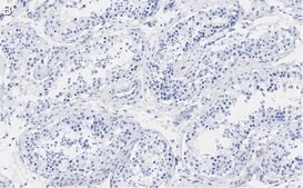 Anti-PER2 Antibody, clone 1G17 ZooMAb® Rabbit Monoclonal recombinant, expressed in HEK 293 cells