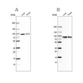 Anti-TF antibody produced in rabbit Ab2, Prestige Antibodies® Powered by Atlas Antibodies, affinity isolated antibody, buffered aqueous glycerol solution