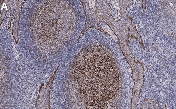 Anti-p75NTR Antibody, clone 1N3 ZooMAb&#174; Rabbit Monoclonal recombinant, expressed in HEK 293 cells