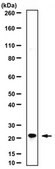Anti-Chromobox protein homolog 3 Antibody from rabbit, purified by affinity chromatography