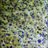 Anti-phospho-BAD (pSer91/128) antibody produced in rabbit affinity isolated antibody