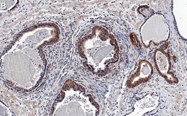 Anti-AKT1 Antibody, clone 4K6 ZooMAb® Rabbit Monoclonal recombinant, expressed in HEK 293 cells