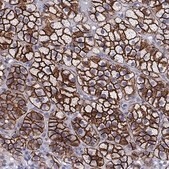 Anti-SCARB1 Prestige Antibodies® Powered by Atlas Antibodies, affinity isolated antibody