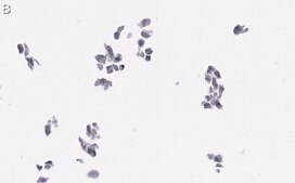 Anti-Cytomegalovirus Antibody, clone 8B1.2 ZooMAb® Mouse Monoclonal recombinant, expressed in HEK 293 cells