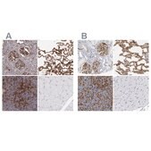 Anti-ICAM1 antibody produced in rabbit Prestige Antibodies® Powered by Atlas Antibodies, affinity isolated antibody, buffered aqueous glycerol solution