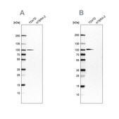 Anti-UFL1 antibody produced in rabbit Prestige Antibodies® Powered by Atlas Antibodies, affinity isolated antibody, buffered aqueous glycerol solution, ab2