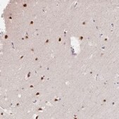 Anti-GTF2H1 antibody produced in rabbit Prestige Antibodies® Powered by Atlas Antibodies, affinity isolated antibody, buffered aqueous glycerol solution