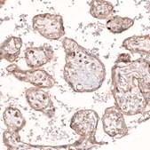 Monoclonal Anti-ROR2 antibody produced in mouse Prestige Antibodies® Powered by Atlas Antibodies, clone CL5950, purified immunoglobulin, buffered aqueous glycerol solution