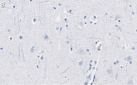 Anti-Neurofilament H Antibody, clone 2N19 ZooMAb® Rabbit Monoclonal recombinant, expressed in HEK 293 cells