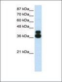 Anti-FOXJ1 antibody produced in rabbit affinity isolated antibody