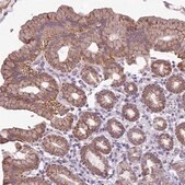 Anti-ALDH2 antibody produced in rabbit Prestige Antibodies® Powered by Atlas Antibodies, affinity isolated antibody, buffered aqueous glycerol solution