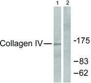 抗-胶原蛋白IV 兔抗 affinity isolated antibody