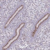 Anti-RAB6A antibody produced in rabbit Prestige Antibodies® Powered by Atlas Antibodies, affinity isolated antibody, buffered aqueous glycerol solution