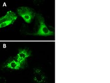 LentiBrite GFP-p62 Lentiviral Biosensor