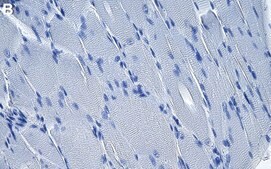 Anti-Hexokinase-2 Antibody, clone 1F3 ZooMAb® Rabbit Monoclonal recombinant, expressed in HEK 293 cells